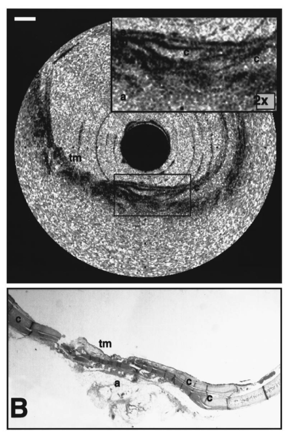 Lasertechnologie (3)