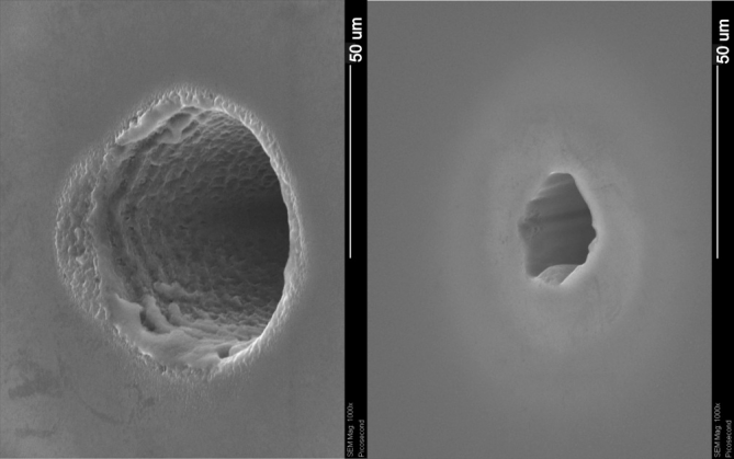 LASER MICROVIA BOREN (10)